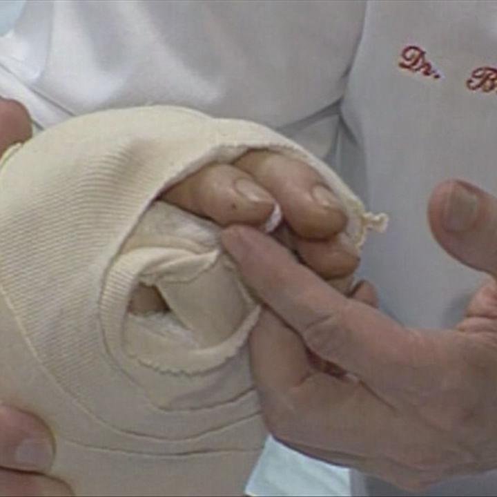 MATTHEW SCOTT - HAND SURGERY 1999 - WDRB (2).jpg
